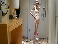 Anorexia Christin Showing Her Bones & Skinny Skeleton