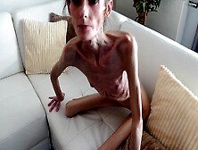 Anorexic Denisa 09-01-2023 8T00781