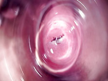 Inside Mia's Vagina,  Internal Camera In Teen Pussy
