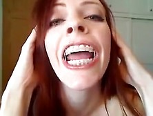 Red-Head With Brackets Joi