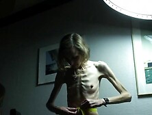 Anorexic Sonja 8T00366