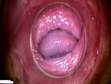 Camera Deep Inside Paula Shy's Vagina (Full Hd Pussy Cam)