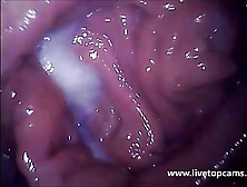 Livetopcams. Com Cam Girl Orgasm Filmed From Inside Vagina