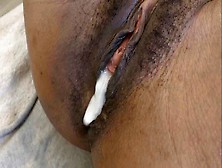 Little African Homemade Twat Gets Creampied By White Penis