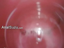 Extreme Japanese Analhole Hairy Sex