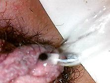 Endoscope Trip Inside My Pee
