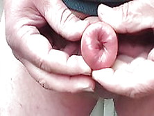 Foreskin Inside Out
