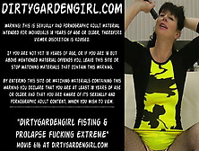 Watch Fisting & Prolapse Fucking Extreme Free Porn Video On Fuxxx. Co