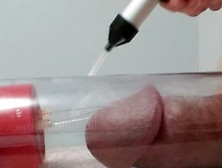 3 Needles At The End Of A Cock Pump