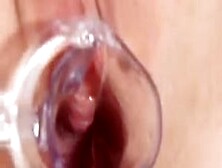 Sophie Gets Her Pussy Explored With A Speculum