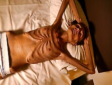 Anorexic Denisa 8T00681 22-02-2021
