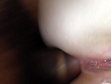 Filled Bumhole