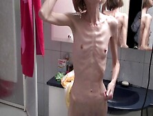 Anorexic Sonja 8T00354