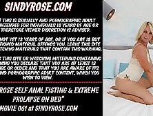 Sindy Rose Self Anal Fisting & Extreme Prolapse On Bed