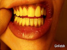 Mouth,  Teeth,  Tongue And Uvula Check (Short Version)