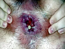 Closeup Up Anal Masturbation With Water Bottle