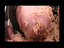 Maggots Fill Pee Hole