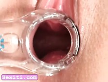 Teen Masturbate With Speculum And Toy